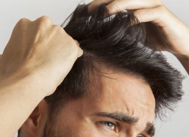 Cortes de cabello para personas que están perdiendo el cabello.